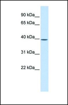 Anti-MAT2B, (N-terminal) antibody produced in