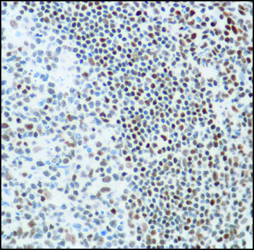 Anti-KU80 antibody, Rabbit monoclonal
