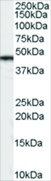 Anti-CASEIN Kinase 1? antibody produced
