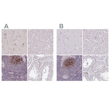 Anti-TMEM119 antibody produced in rabbit