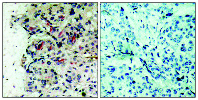 Anti-JAK1 antibody produced in rabbit
