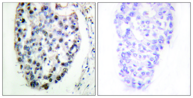 Anti-MYF5 antibody produced in rabbit