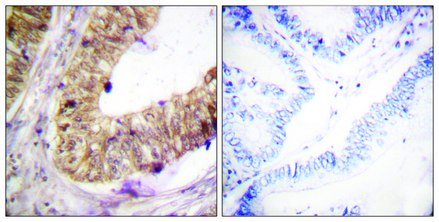Anti-ATRIP antibody produced in rabbit