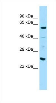 Anti-ANGPT1 antibody produced in rabbit