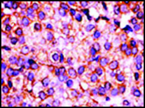 Anti-PANK3 (N-term) antibody produced in