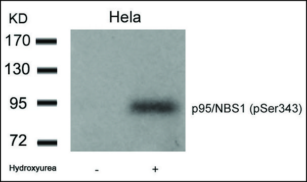 Anti-phospho-NBN (pSer³?³) antibody produced in