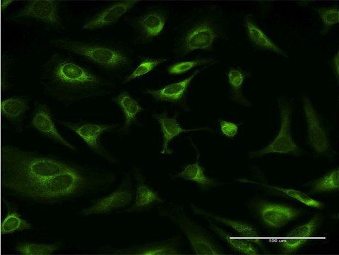 Monoclonal Anti-RPN1, (C-terminal) antibody produced