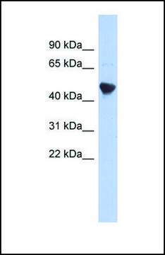 Anti-IER5L antibody produced in rabbit