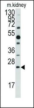 Anti-DUSP18 (C-term) antibody produced in