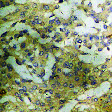 Anti-phospho-CaMK2 ?/?/? (pThr³??) antibody produced