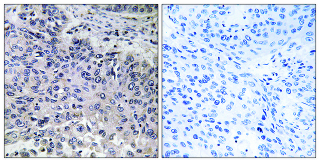 Anti-C1QC antibody produced in rabbit