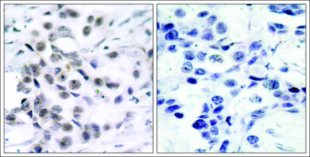 Anti-CHEK1 (Ab-317) antibody produced in
