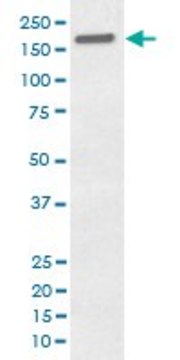 Monoclonal Anti-EGFR (phospho Y1173) antibody