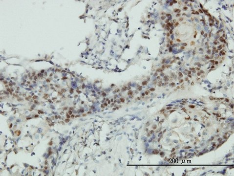 Monoclonal Anti-RNMT antibody produced in