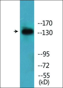 Anti-phospho-EGFR (pTyr¹?¹?) antibody produced in