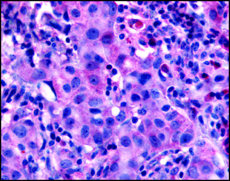 Anti-NANP (AB3) antibody produced in