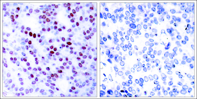 Anti-JUN (Ab-243) antibody produced in