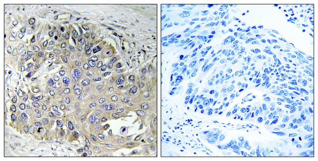 Anti-SPTBN5 antibody produced in rabbit