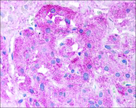 Anti-SEMA3E antibody produced in goat