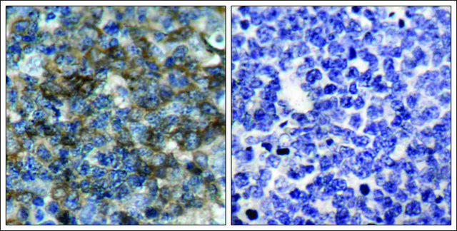 Anti-phospho-VASP (pSer¹??) antibody produced in