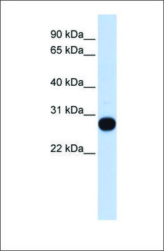 Anti-TCEAL4 antibody produced in rabbit