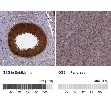 Anti-GSS antibody produced in rabbit