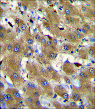 ANTI-HPR (CENTER) antibody produced in