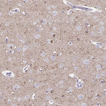 Anti-UGT3A1 antibody produced in rabbit