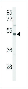 ANTI-S39A8 (CENTER) antibody produced in