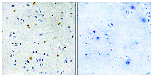 Anti-DIL-2 antibody produced in rabbit