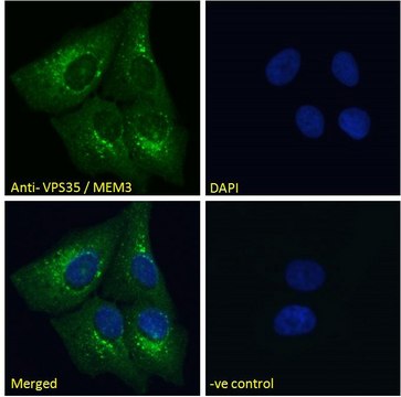 Anti-B5 Receptor/PCID1/EIF3M antibody produced in