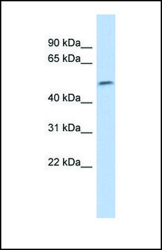 Anti-SOX11 antibody produced in rabbit