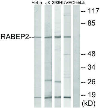 Anti-RABEP2 antibody produced in rabbit