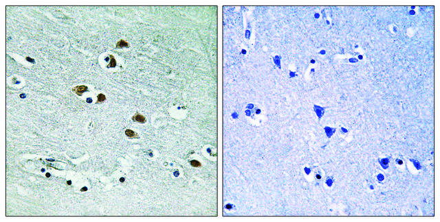 Anti-HDAC6 antibody produced in rabbit
