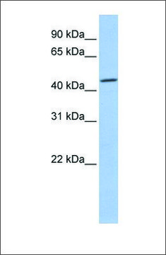 Anti-CSNK2A1 antibody produced in rabbit