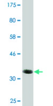 Monoclonal Anti-BAALC, (C-terminal) antibody produced