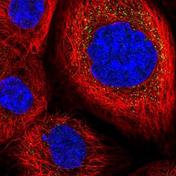 Anti-DESI2 antibody produced in rabbit