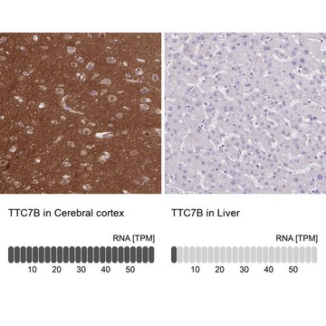 Anti-TTC7B antibody produced in rabbit