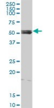 Anti-LYN antibody produced in rabbit