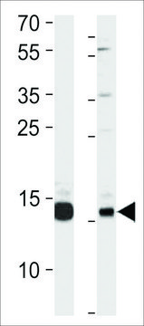 ANTI-PAN SUMO antibody produced in