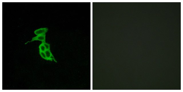 Anti-GPR143 antibody produced in rabbit