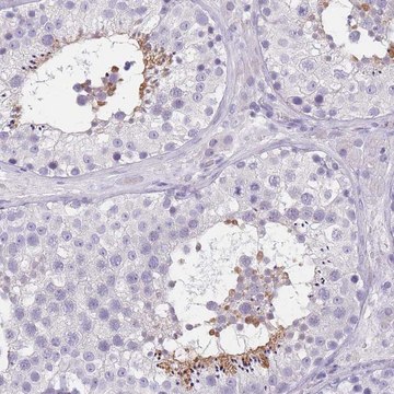 Anti-TCP11 antibody produced in rabbit