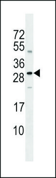 ANTI-SOST(N-TERMINAL) antibody produced in rabbit