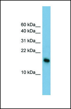 Anti-BATF3, (N-terminal) antibody produced in