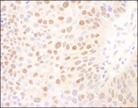Rabbit anti-BMI1 Antibody, Affinity Purified