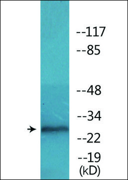 Anti-phospho-RFA2 (pThr²¹) antibody produced in