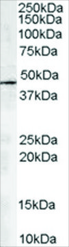 Anti-ARP1 homolog A antibody produced