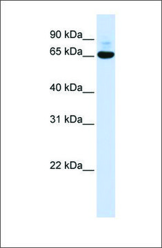 Anti-CNOT4 antibody produced in rabbit