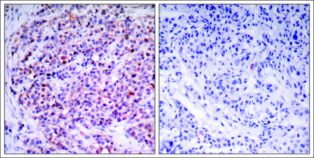Anti-RELA (Ab-435) antibody produced in