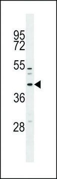 ANTI-MFF (CENTER) antibody produced in